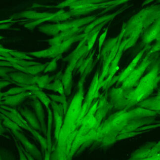 green fluorescent human colonic fibroblasts