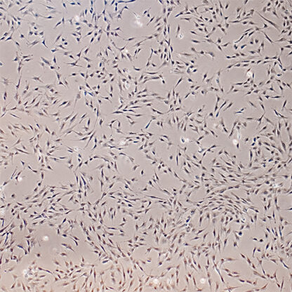 Immortalized Human Osteoblasts