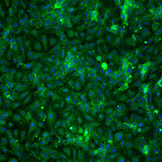 CD31 staining for immortalized HUVEC