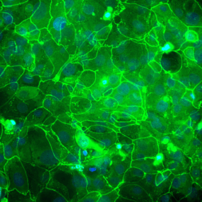 epidermal keratinocytes