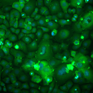 epidermal keratinocytes