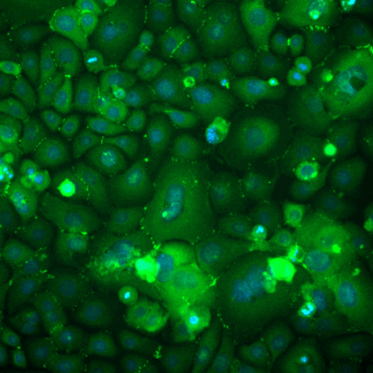 epidermal keratinocytes