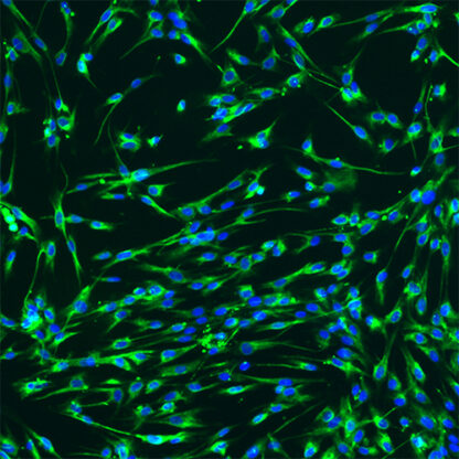 Immortalized Human Brain Vascular Pericytes