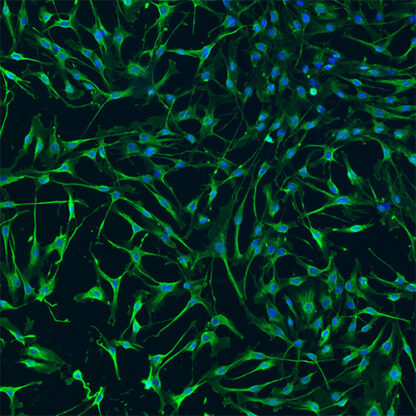 Immortalized Human Brain Vascular Pericytes