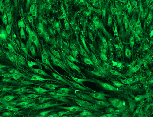 Green Fluorescent Human Tenocytes