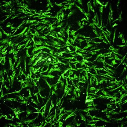 Immortalized Human Osteoblasts