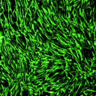 Immortalized Human Osteoblasts