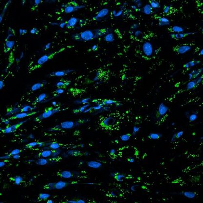 preadipocytes
