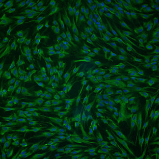 Immortalized Human Retinal Astrocytes - GFAP