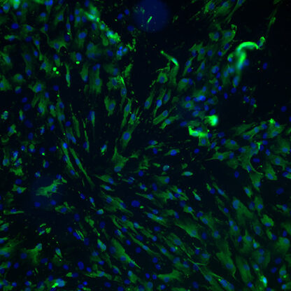 Immortalized Human Retinal Astrocytes - Vimentin