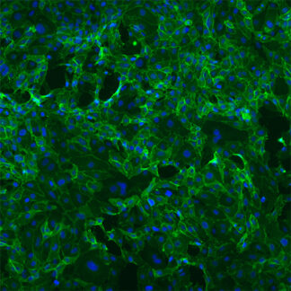 Immortalized Human Pancreatic Endothelial Cells