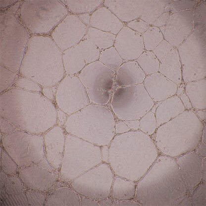 Immortalized Human Pancreatic Microvascular Endothelial Cells