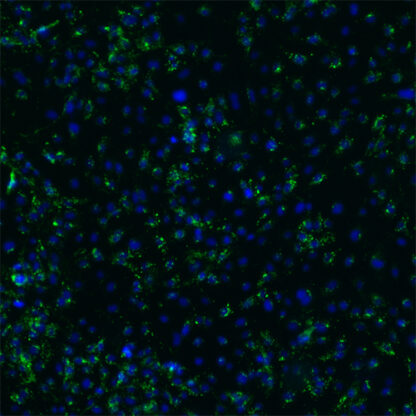 Immortalized Human Pancreatic Microvascular Endothelial Cells