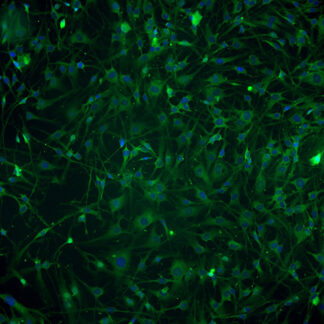 Immortalized Human Retinal Pericytes - a-SMA