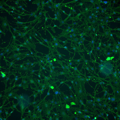 Immortalized Human Retinal Pericytes - PDGF