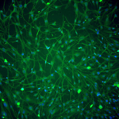 Immortalized Human Retinal Pericytes - Vimentin