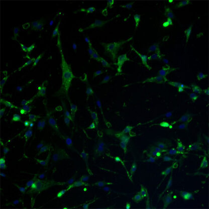 Immortalized Human Chondrocytes - CD56