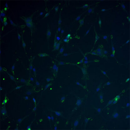 Immortalized Human Chondrocytes - Collagen II