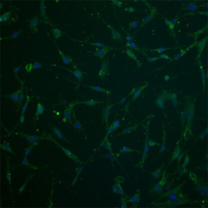 Immortalized Human Chondrocytes - S100B