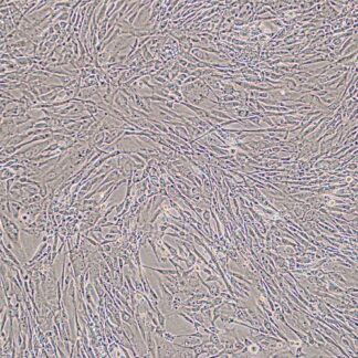 preadipocytes