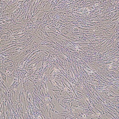 preadipocytes