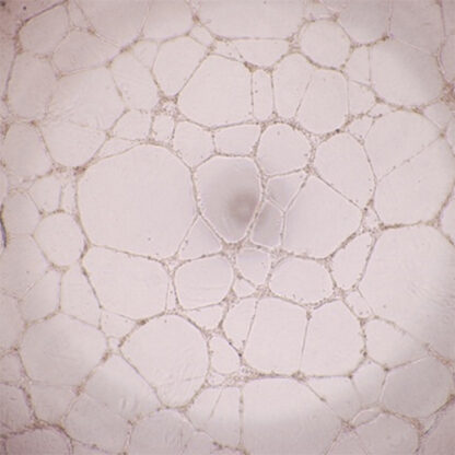 tubule formation with immortalized HUVEC