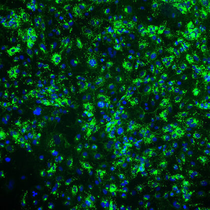 VWF staining with immortalized HUVEC