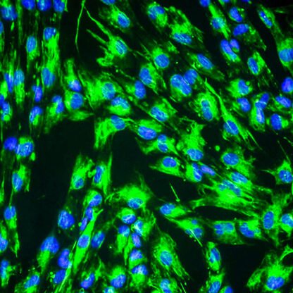 Immortalized Human Dental Pulp Stem Cells