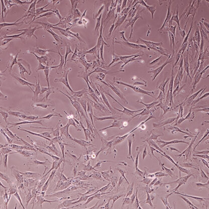Immortalized Human Dental Pulp Stem Cells