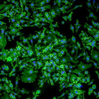 immortalized mouse kupffer cells