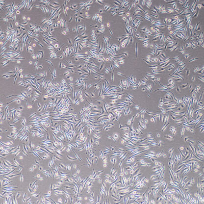immortalized mouse kupffer cells