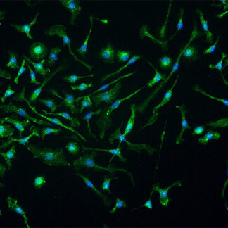 Mouse Kupffer Cells