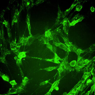 Immortalized Human Dental Pulp Stem Cells