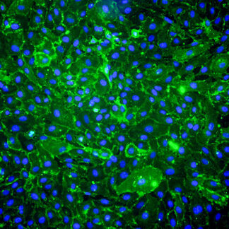 Immortalized Human Cardiac Microvascular Endothelial Cells