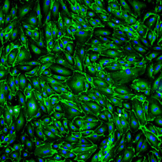 Immortalized Human Splenic Endothelial Cells