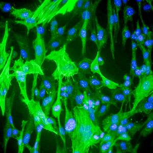Immortalized Human Small Intestine Smooth Muscle Cells