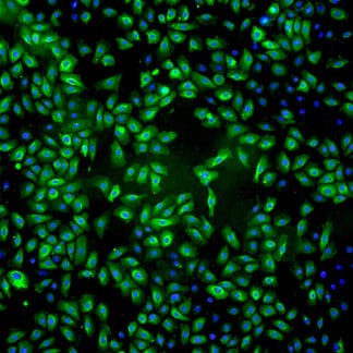 Immortalized Human Mammary Epithelial Cells