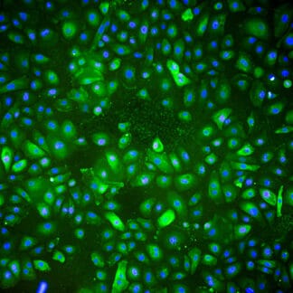 Immortalized Human Urothelial Cells