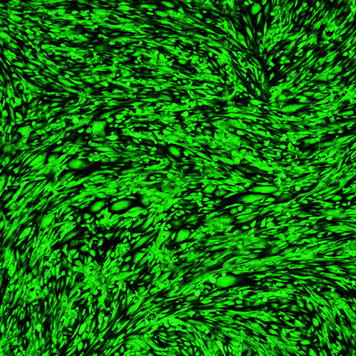 Immortalized Human Skeletal Muscle Myoblasts