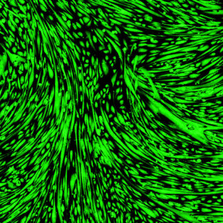 Immortalized Human Skeletal Muscle Myoblasts