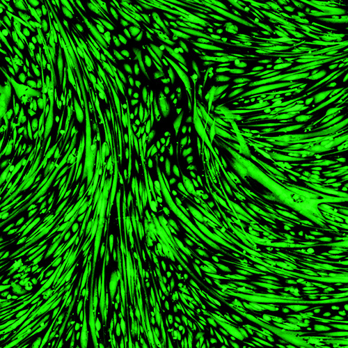 Immortalized Human Skeletal Muscle Myoblasts