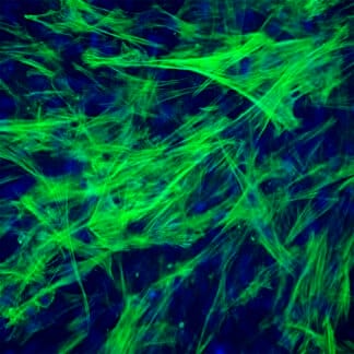 Human Small Intestine Smooth Muscle Cells