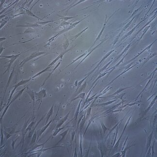 Human Adipocytes