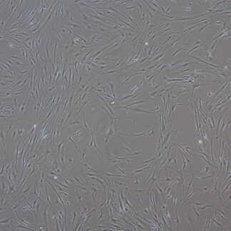 Human dermal fibroblasts