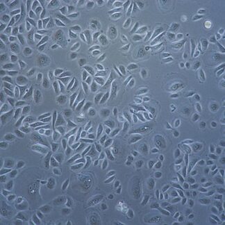 Human Epidermal Keratinocytes