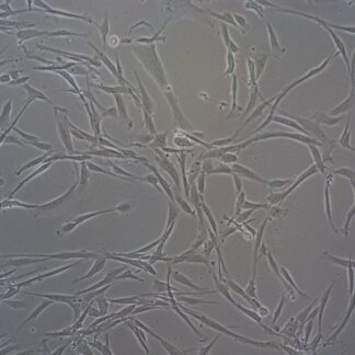 human sebocytes