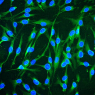 Human Bone Marrow stem cells