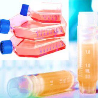 primary cells and cell lines